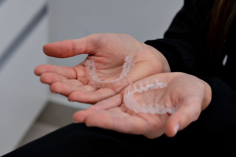 Clear aligners Arizona: comparing written plan and monitoring visit estimates