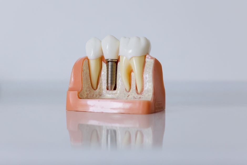 Dentures or implants Arizona: patient comparing two written dental estimates
