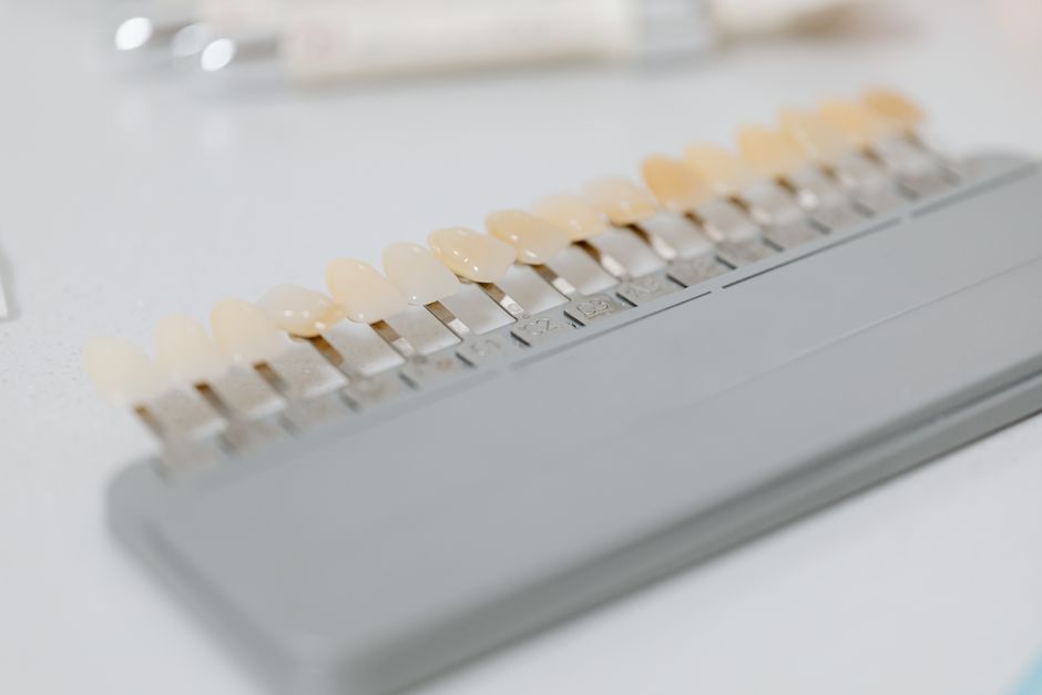 Porcelain crowns Arizona: comparing temporary and final crown estimate lines