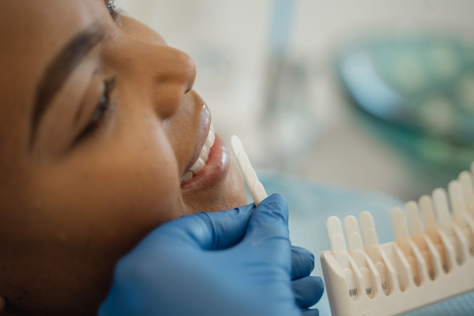 Teeth whitening Arizona: comparing in-office and take-home estimate lines